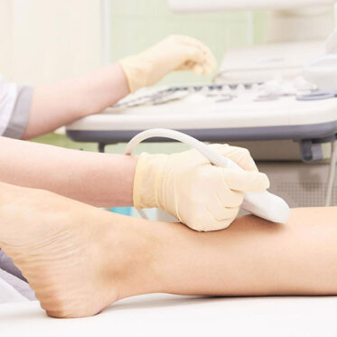 doppler-1 Lower limb ultrasound - two limbs - Image 1